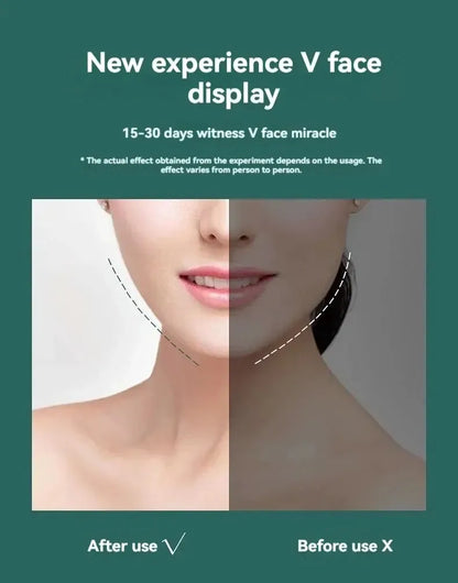 Slimming Face Lifting Belt – Double Chin Reduction & V-Line Sculpting Mask